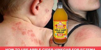 Use Apple Cider Vinegar To Treat Eczema